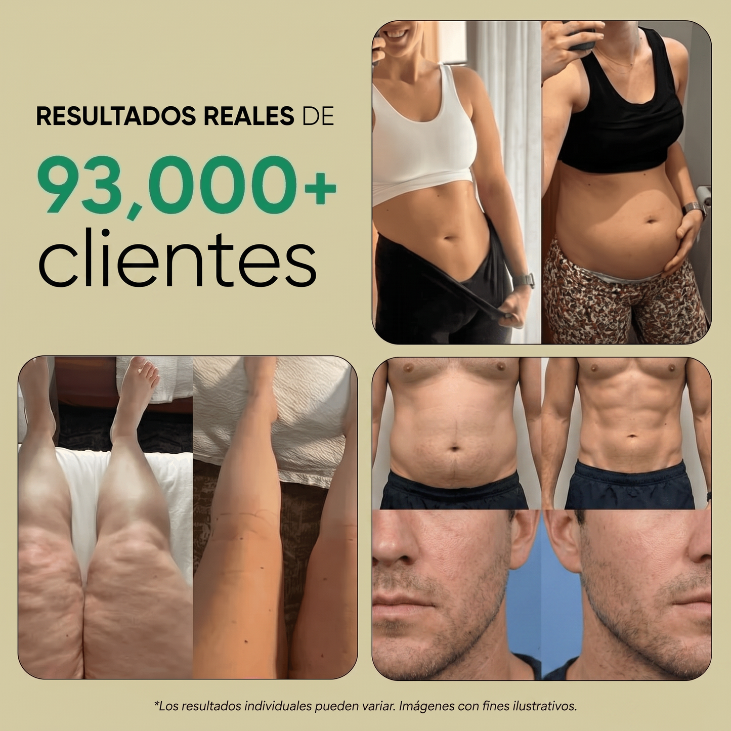Nueva fórmula de máxima potencia: Cápsulas de drenaje linfático renal de Sculptique™ - Orina Espumosa