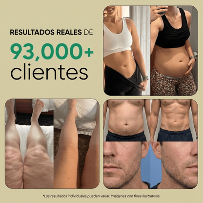 Nueva fórmula de máxima potencia: Cápsulas de drenaje linfático renal de Sculptique™ - Orina Espumosa