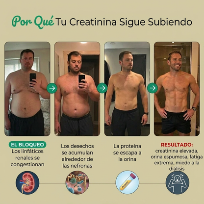 Nueva fórmula de máxima potencia: Cápsulas de drenaje linfático renal de Sculptique™ - Orina Espumosa
